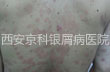 淶ƣڻָ